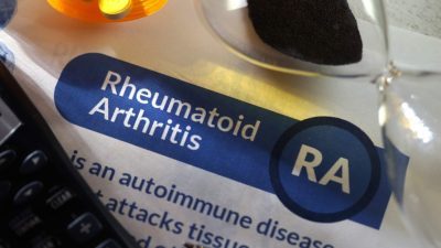 Rheumatoid arthritis